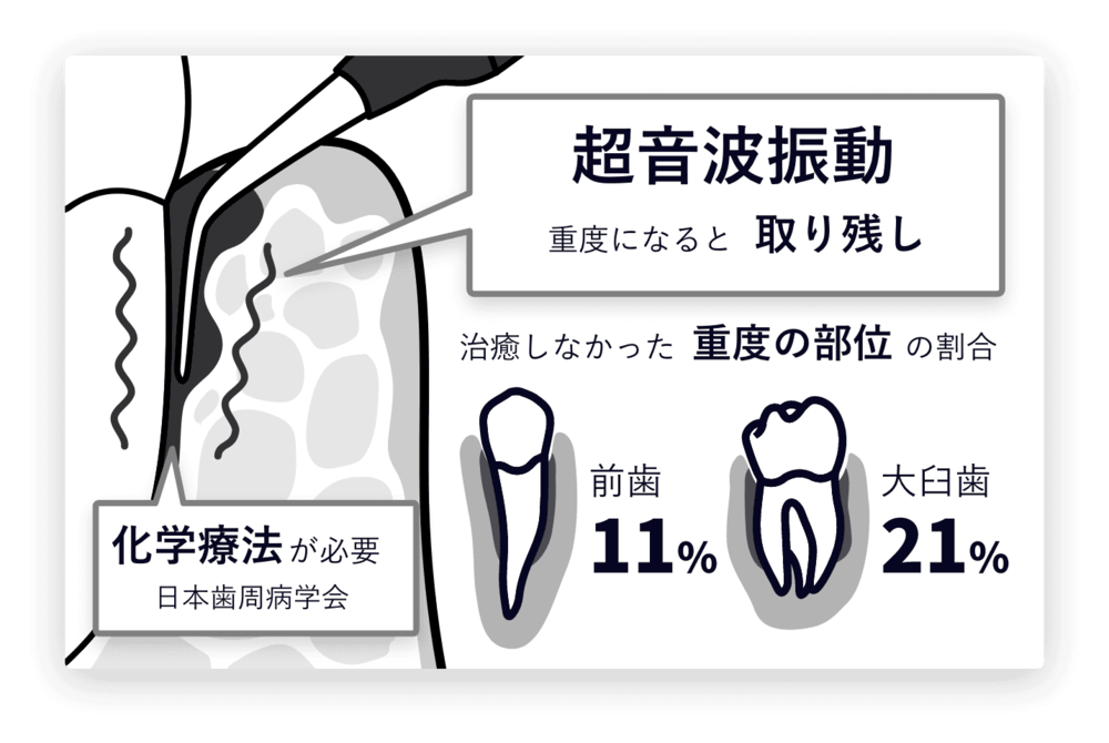 世田谷北沢 医療法人社団 燦陽会 下北沢駅前歯科クリニック 痛みの少ない治療で身体への負担を軽減