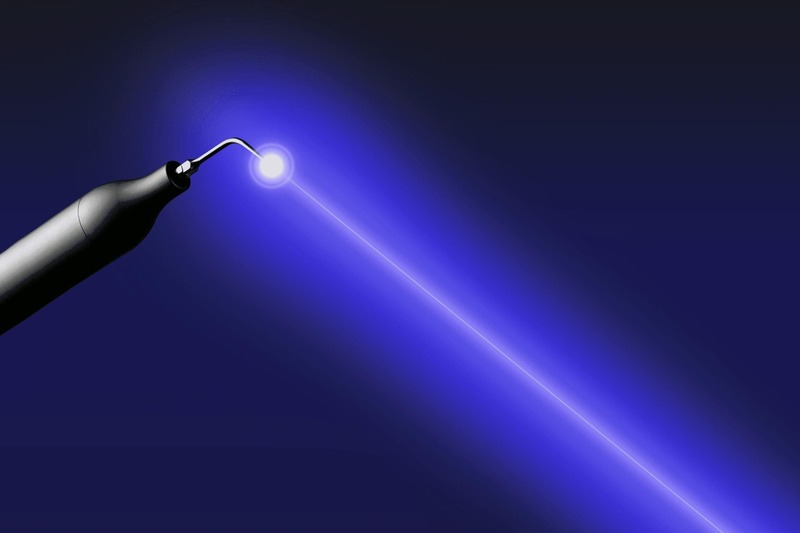 世田谷北沢 医療法人社団 燦陽会 下北沢駅前歯科クリニック ブルーラジカルを使った治療の実施。