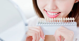 歯の色サンプルを自分の歯に当てて比較する女性