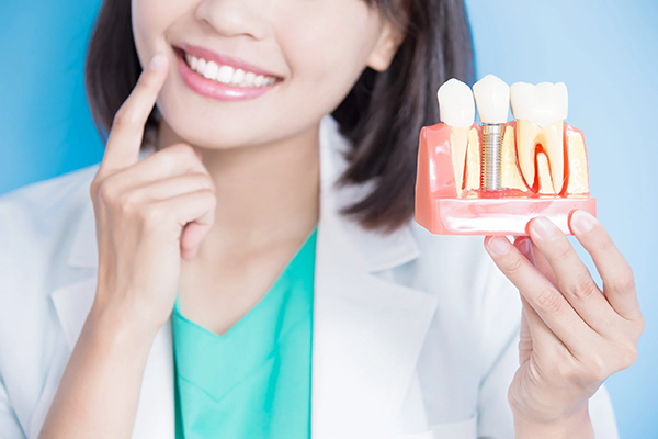 インプラントの模型を持っている白衣を着た女性