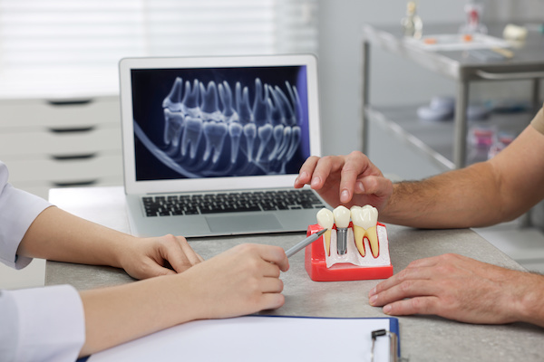 インプラント治療中に歯がない期間はある？対応法を解説！