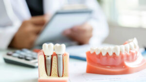 歯のブリッジ・インプラント・入れ歯の費用を比較して説明する歯科医師