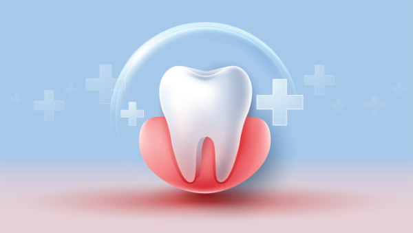 歯虫予防でフッ素塗布した歯のイメージ