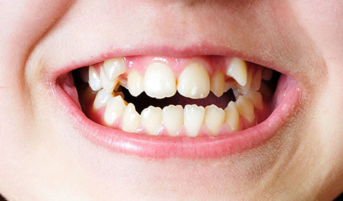 世田谷北沢 医療法人社団 燦陽会 下北沢駅前歯科クリニック お子さまの歯