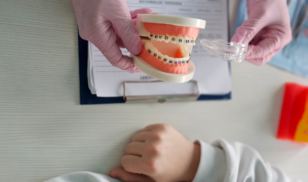 マウスピース矯正とワイヤー矯正について説明を受ける様子