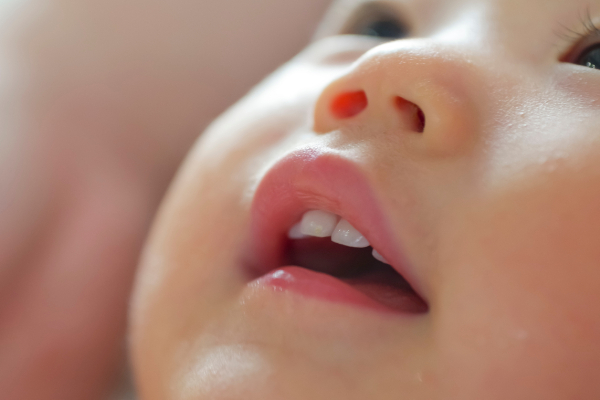 子どもが口呼吸を続けるとどんなリスクがある？原因や治し方も