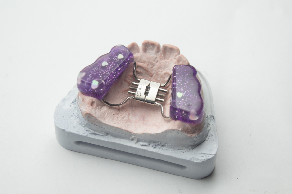 急速拡大装置で顔に変化がある？治療のメリットと注意点も