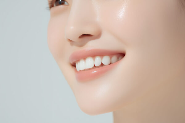 前歯を美しく！ラミネートベニアのメリットや費用を解説