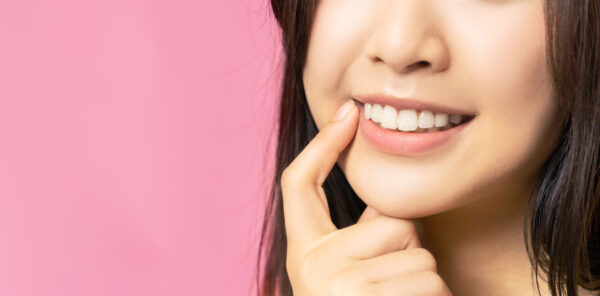 ラミネートベニアで歯を綺麗にしている女性