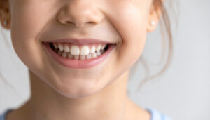 矯正治療ですきっ歯が治り笑顔になる子ども