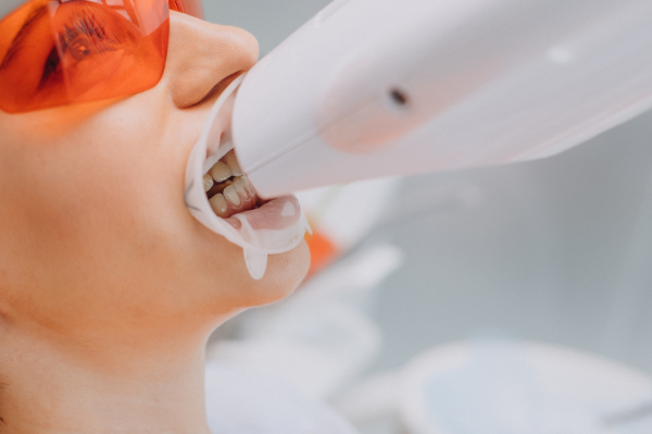 オフィスホワイトニング中の女性