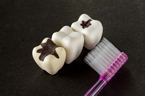 歯磨きしにくいことを示す虫歯の模型と歯ブラシ