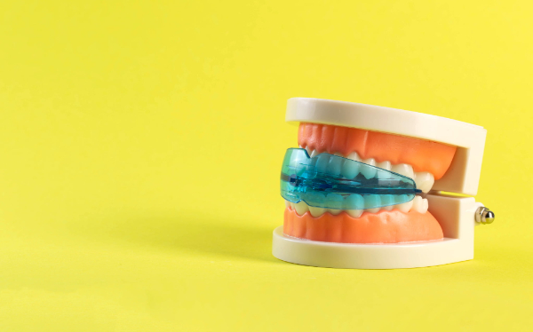 マイオブレースを装着した歯の模型