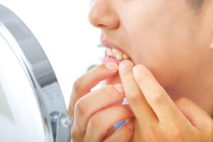 口腔トラブルを気にする男性